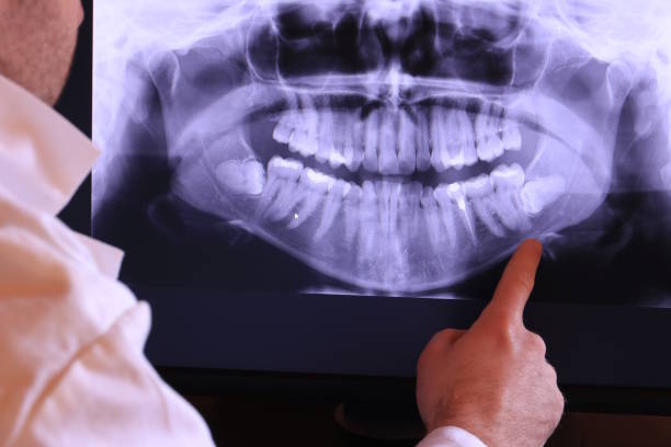 Best Emergency Dental Services for Seniors in Potosi, MO