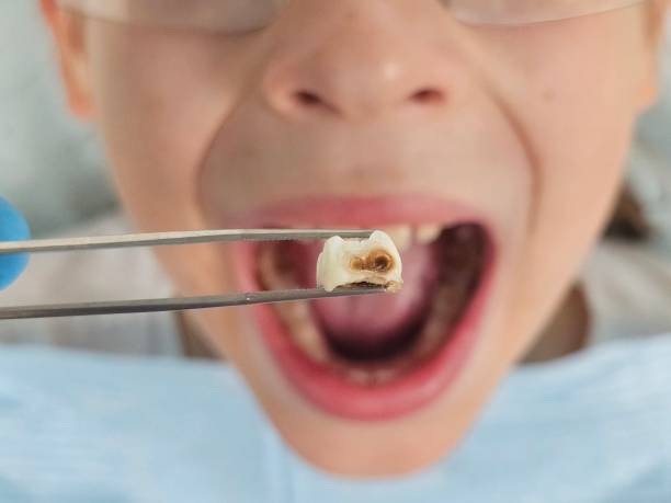 Best Weekend Emergency Dentist in Potosi, MO